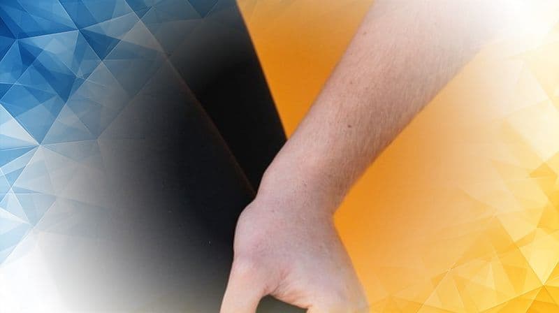 Clinical Insights and Rehabilitation Challenges of Anterior Cruciate Ligament Tears in Eagles