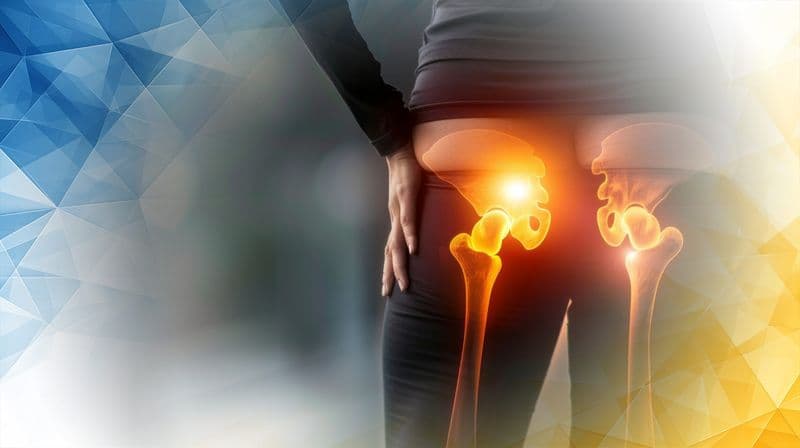 Iliopsoas Bursitis and the Inflammatory Origins of Hip Pain