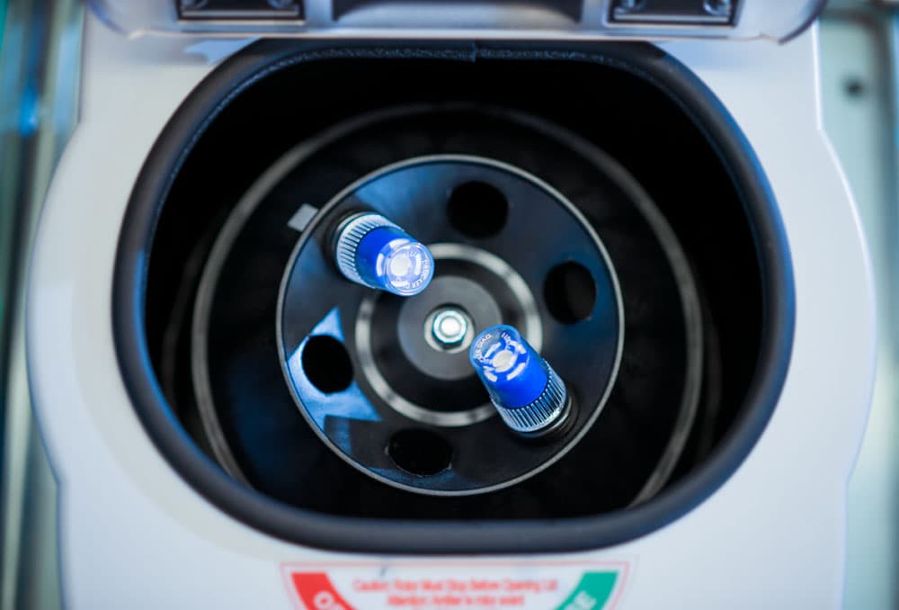 PRP vs. Cortisone for Knee Treatment: A Comprehensive Guide for Patients