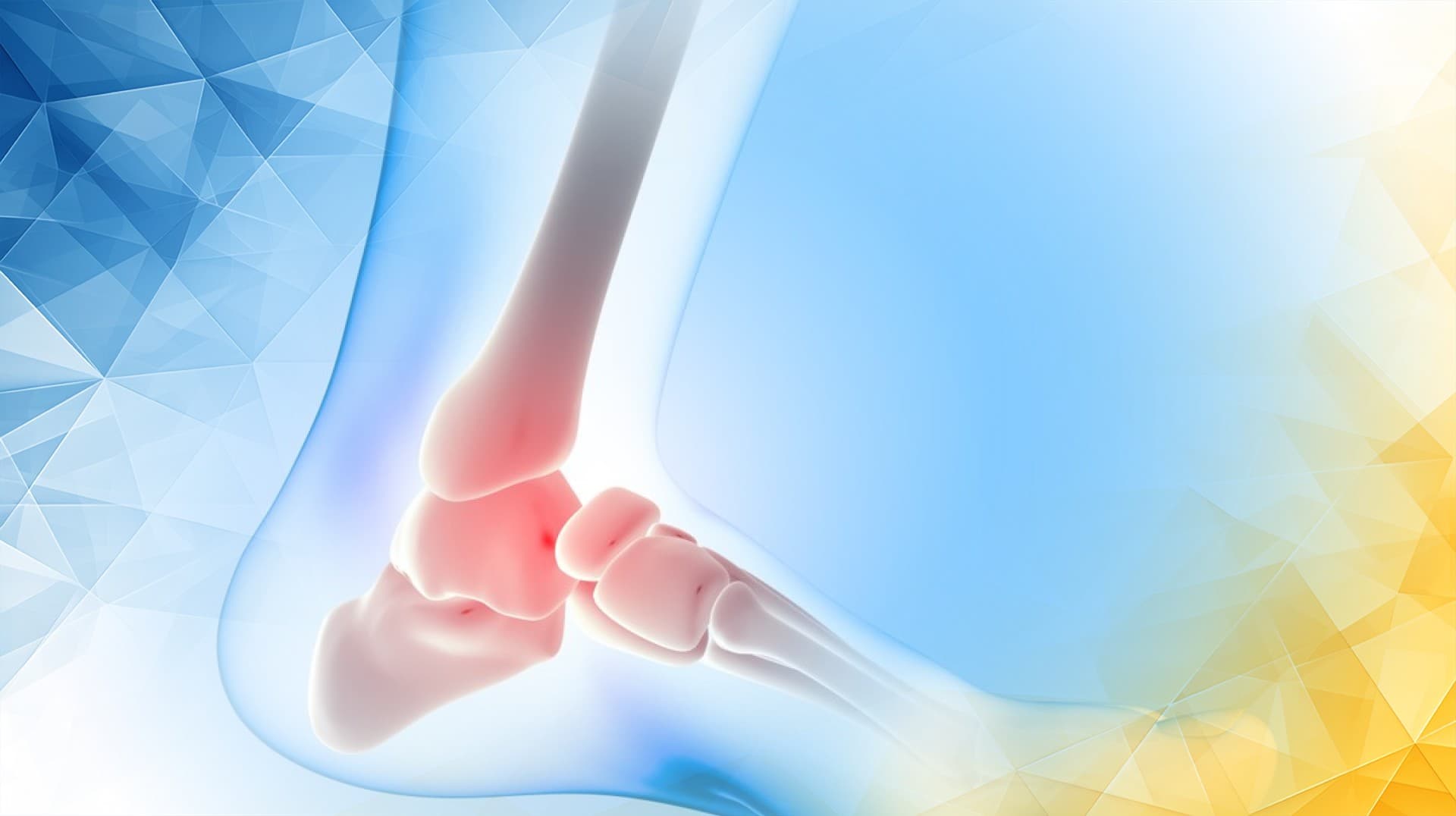 Ankle Cartilage Repair Recovery and Clinical Care