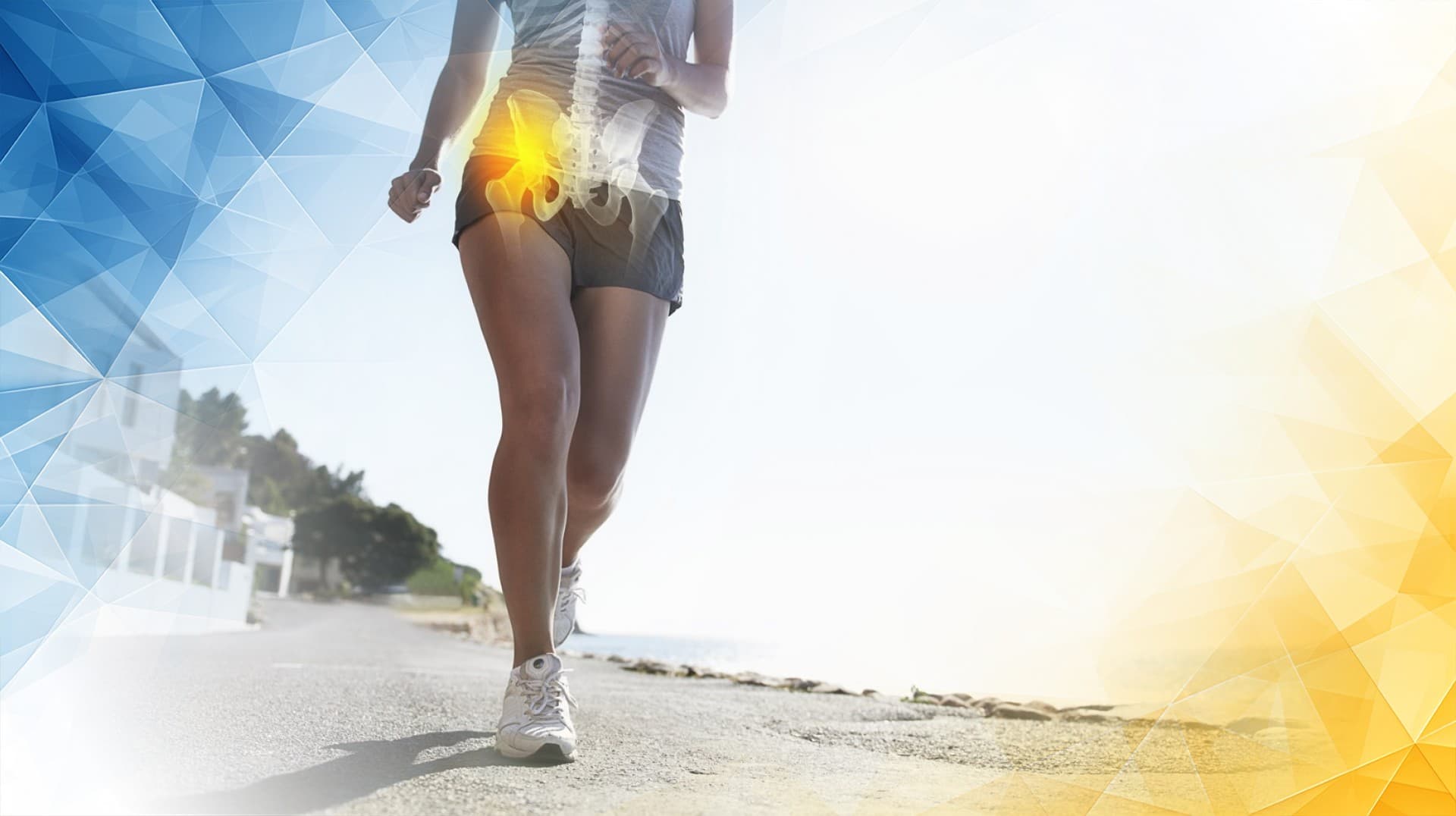 ChondroFiller Treatment Advances for Hip Labrum Tears and Early Arthritis