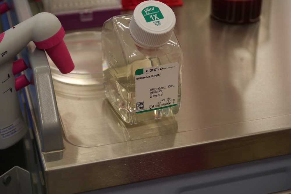 Cartilage cells cultured for cell therapy at London Cartilage Clinic