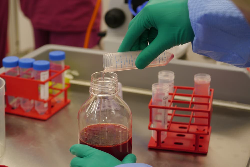 Cartilage cells cultured for cell therapy at London Cartilage Clinic