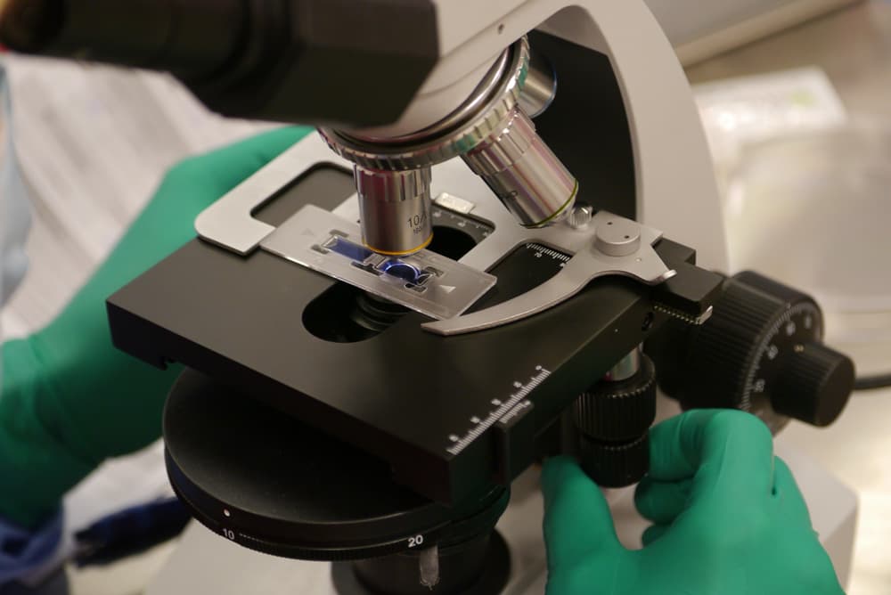 Cartilage cells assessed in the laboratory at London Cartilage Clinic