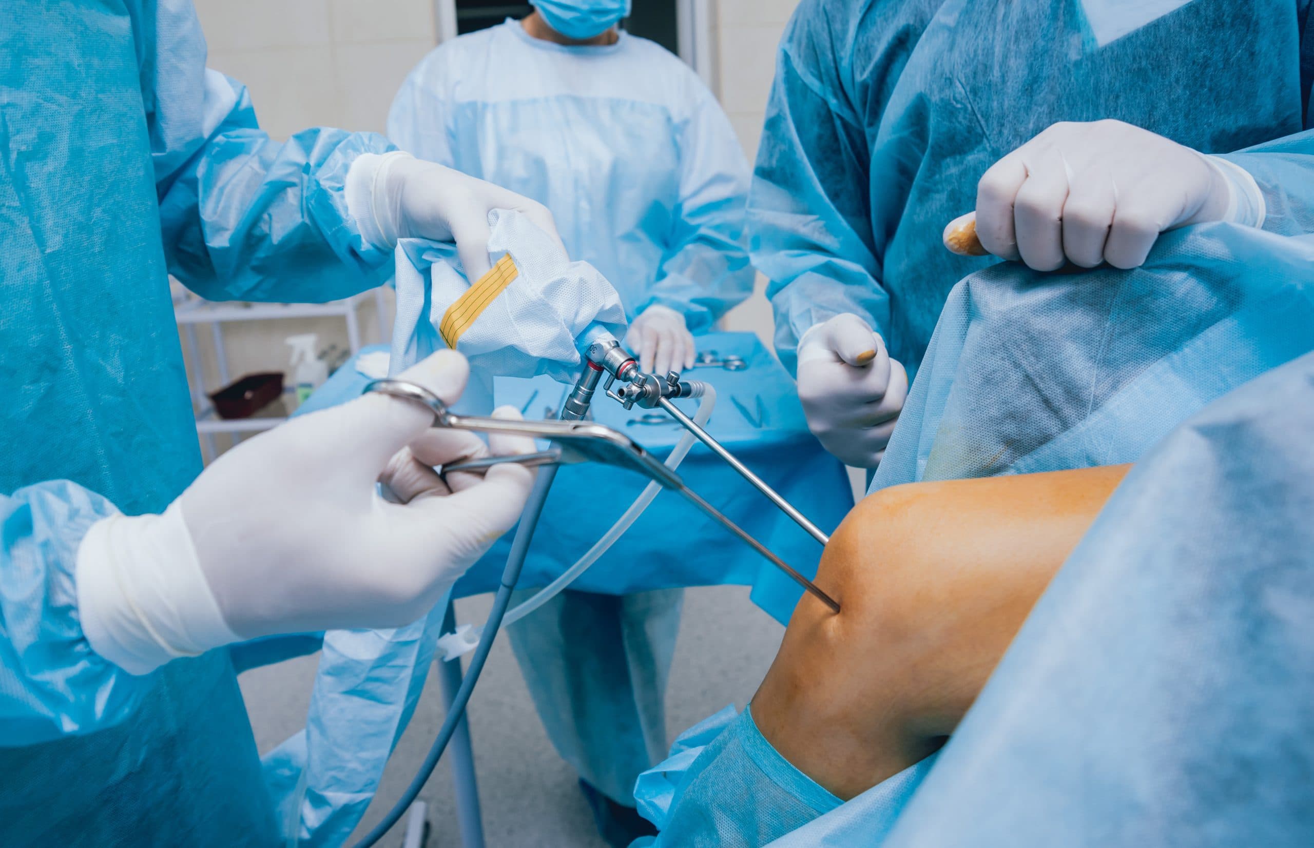 Arthroscopic knee surgery being performed in operating theatre