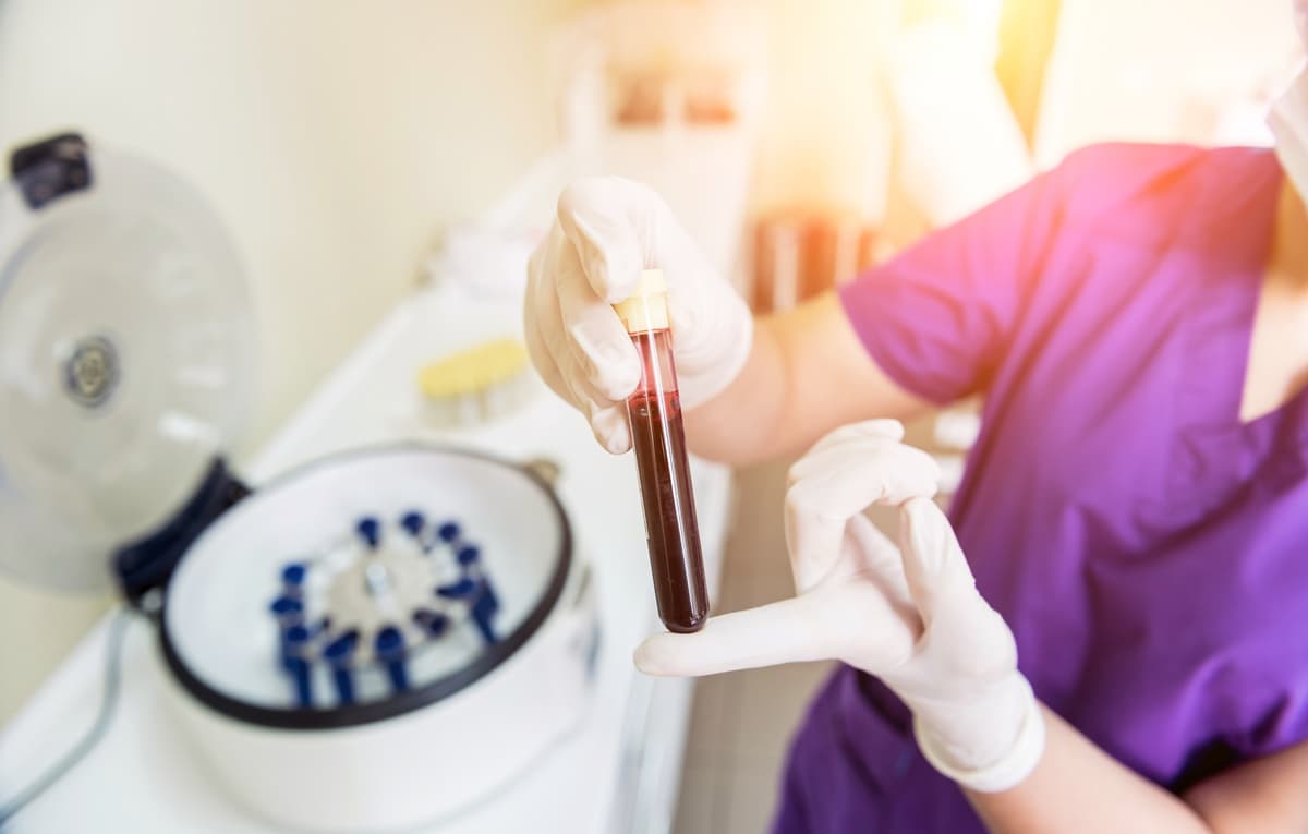 PRP Injections | PRP Treatment | UK | London Cartilage Clinic