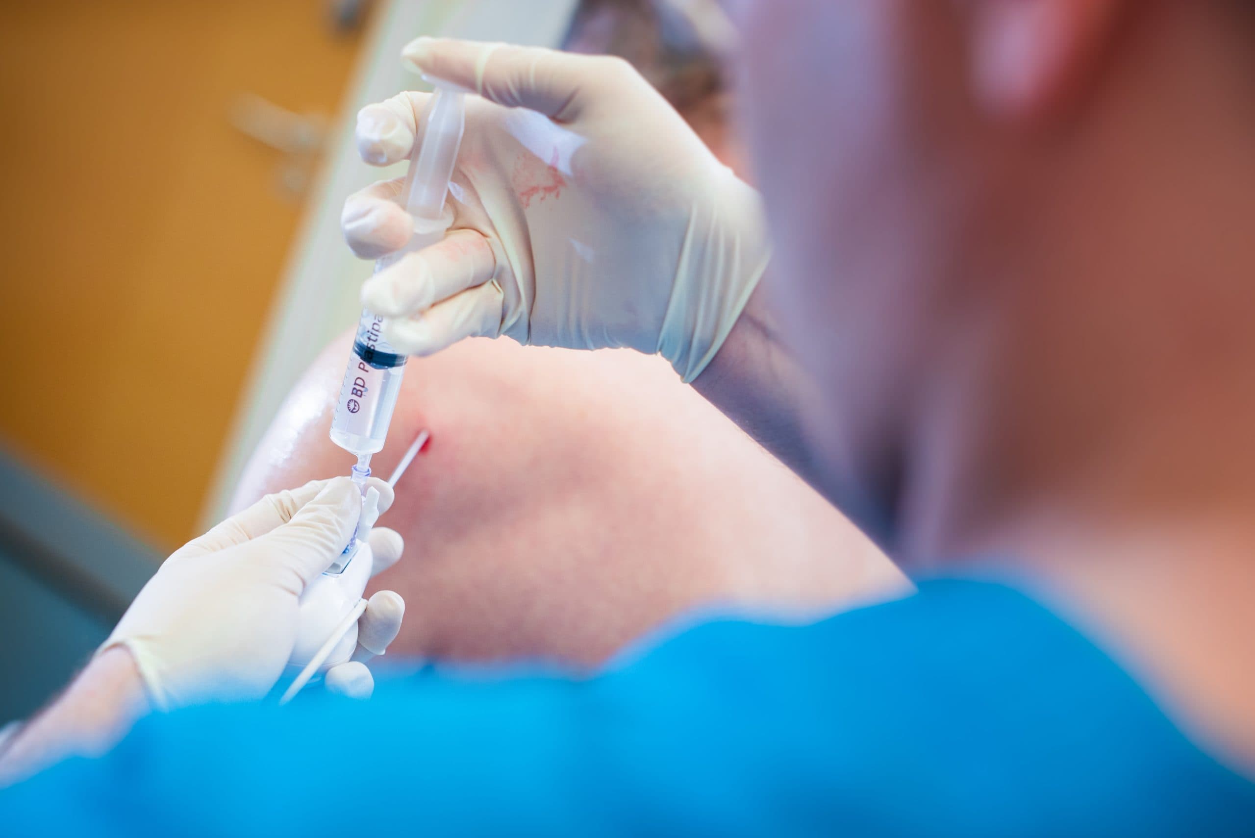 Close-up of a joint injection procedure
