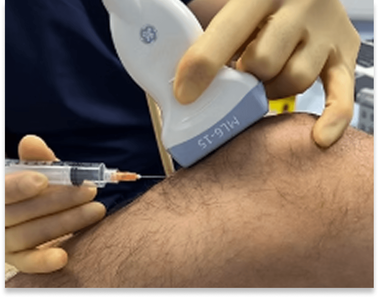 Ultrasound-guided intra-articular placement