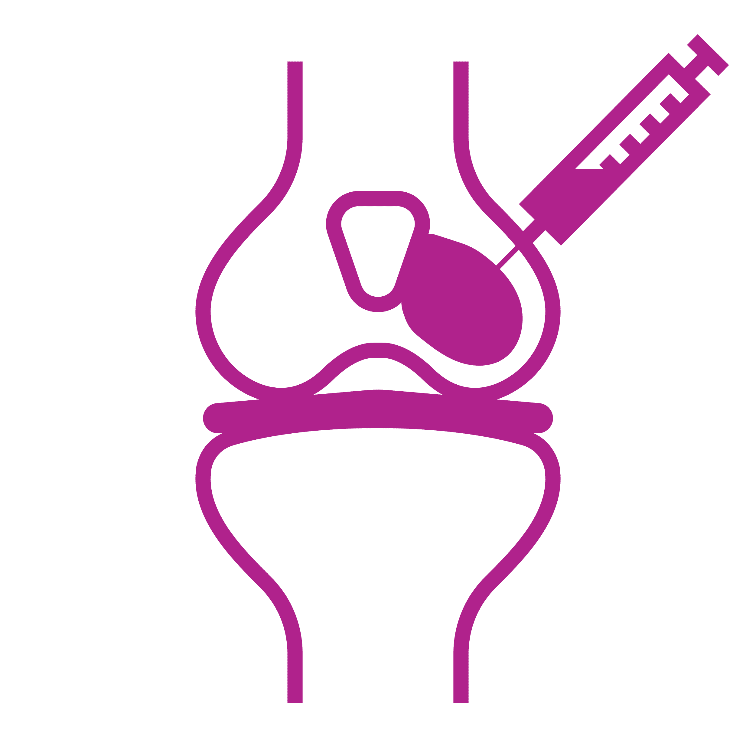 Meniscus cartilage replacement illustration