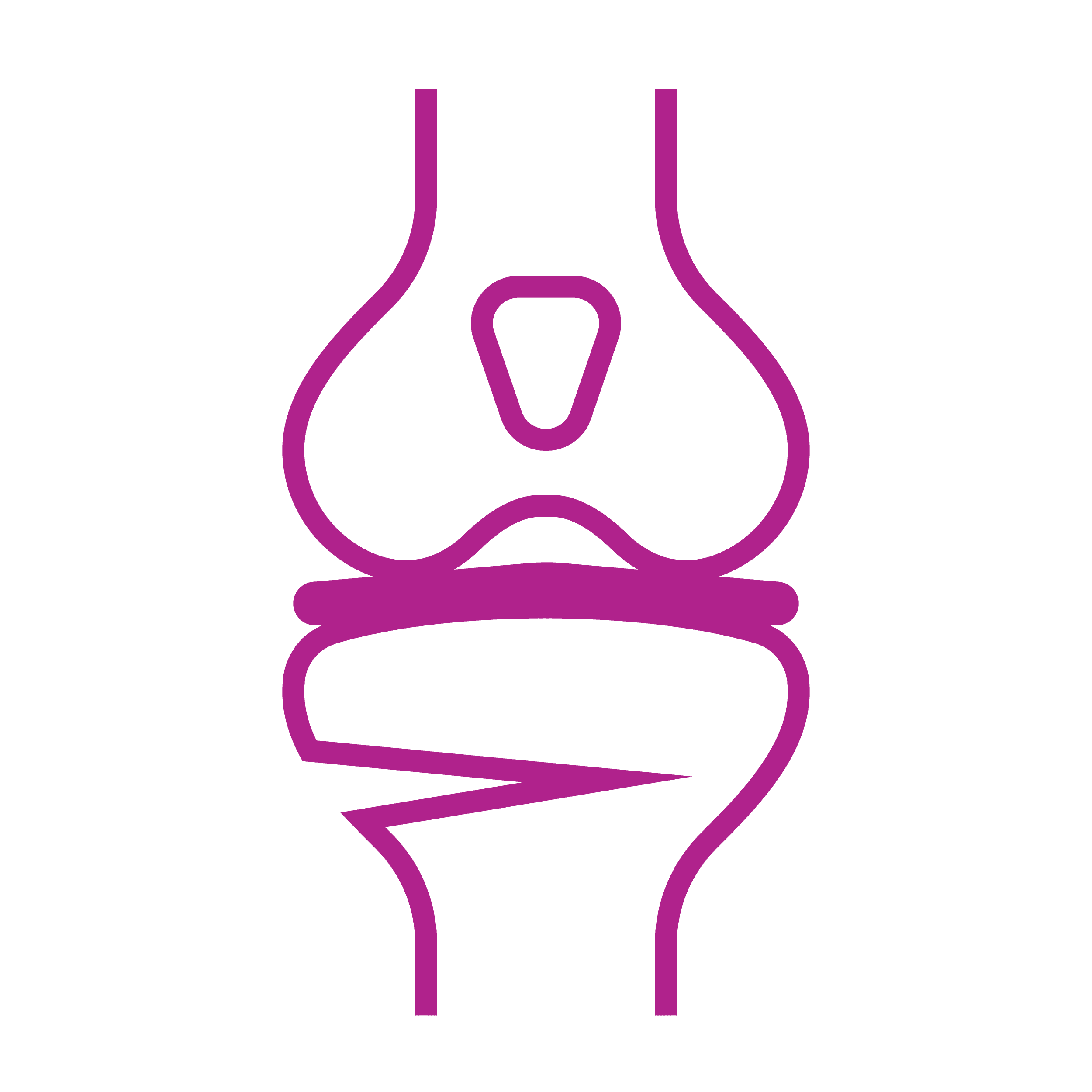 Osteotomy illustration