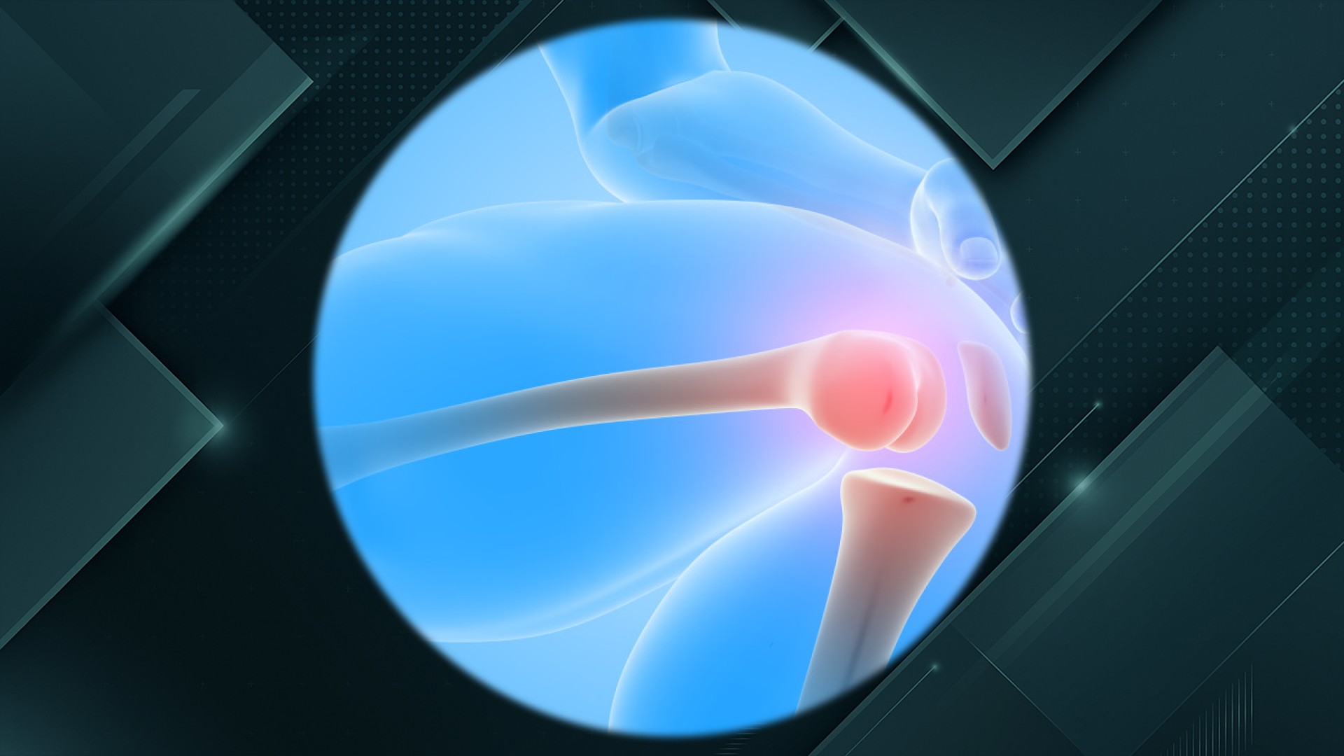 Decoding Tiger’s ACL Tear: A Biomechanical Deep Dive into a Sports Icon’s Injury