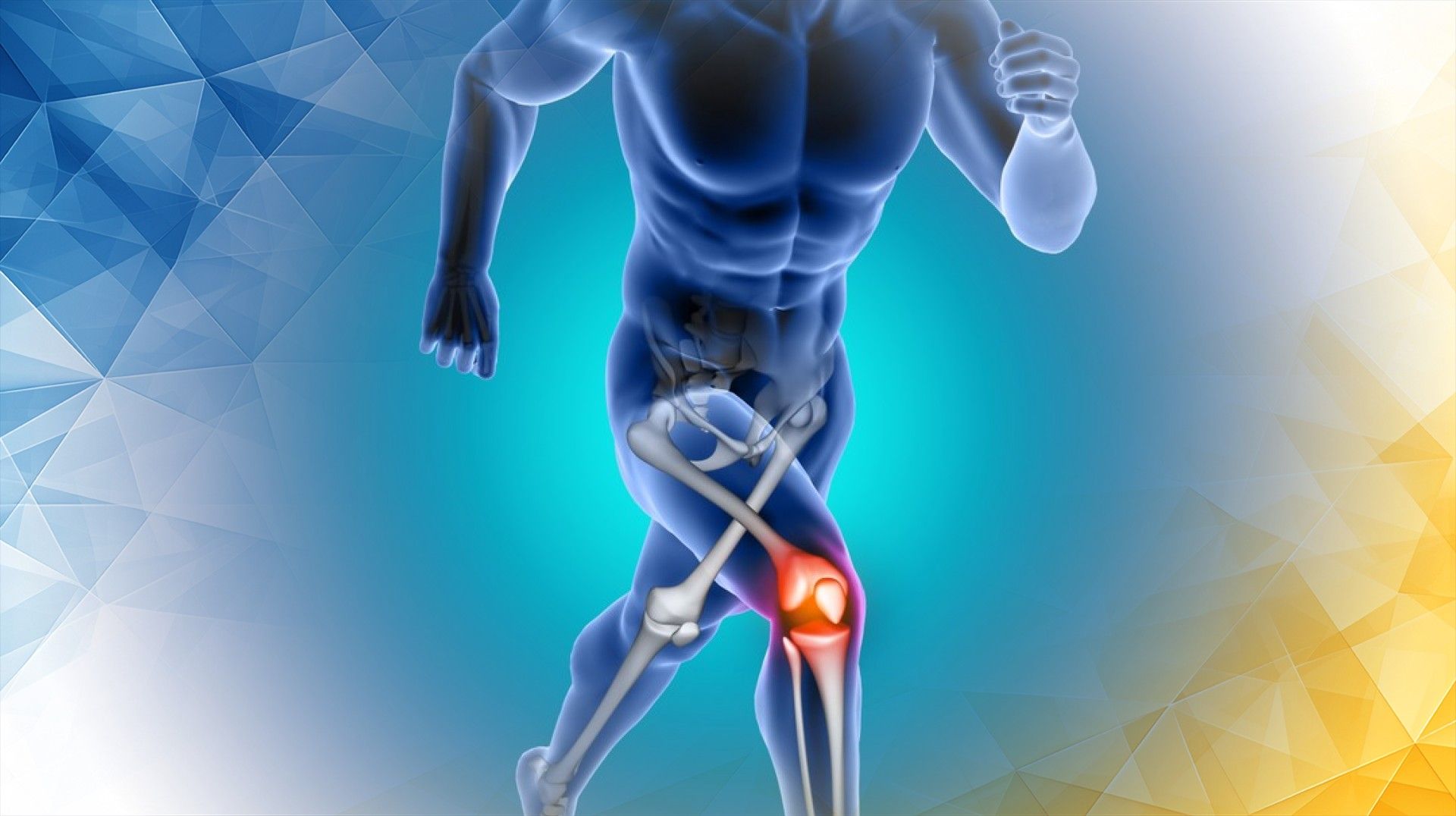 The Crucial Role of Knee Anatomy in Determining ACL Tear Outcomes: Understanding Structure, Variations, and Treatment Implications
